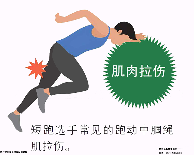 运动损伤康复 (2).png 运动损伤康复 (2).png